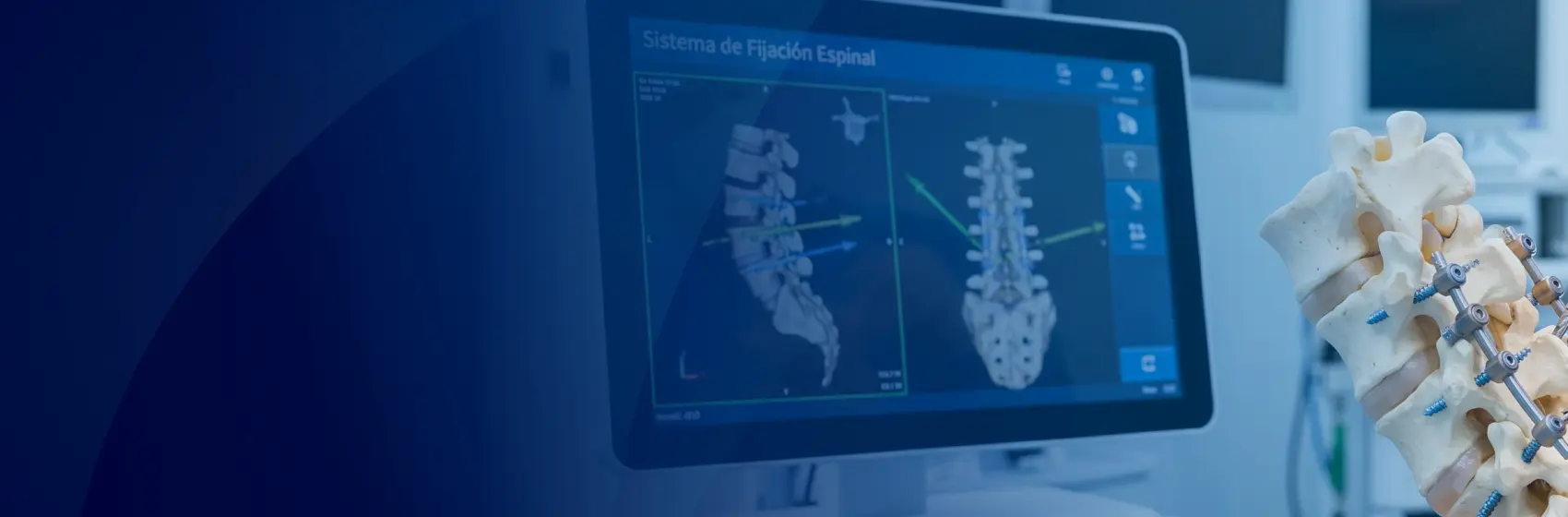 Implantes quirúrgicos